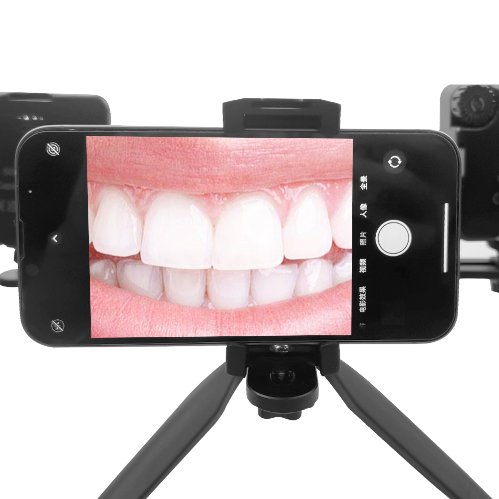 Dental Photography Light Intra - Photography Lighting Lamp avis et prix