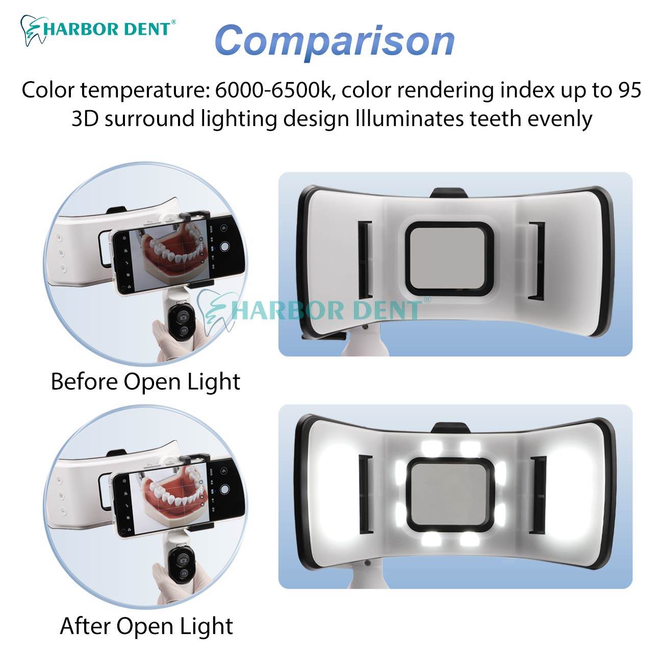 Good Price Dental Photography  - Good Lighting In Photography avis et prix